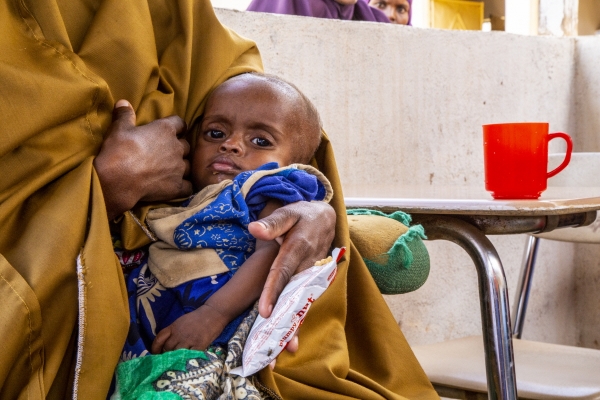 가뭄 등으로 식량 가격이 계속 급등하면서 기아 위기에 놓여있는 소말리아 아동 가정의 모습