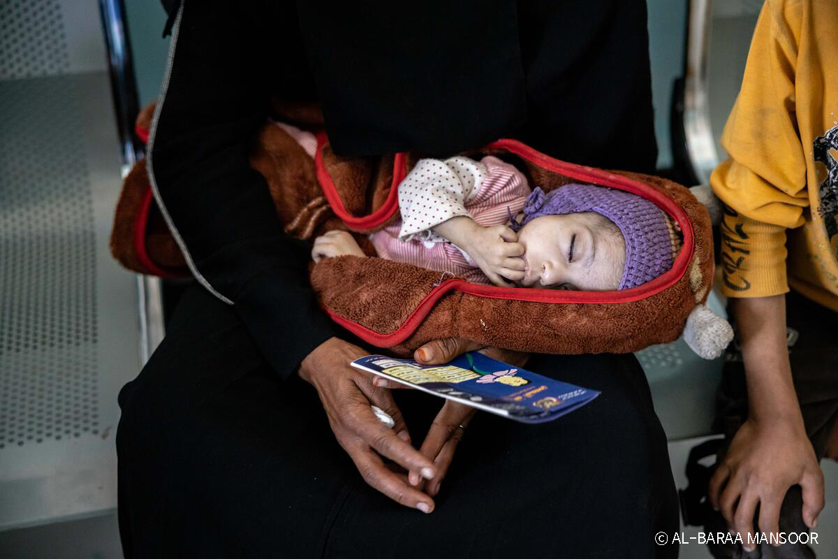 세이브더칠드런 예멘의 한 센터에서 영양실조 치료를 받고 있는 렘