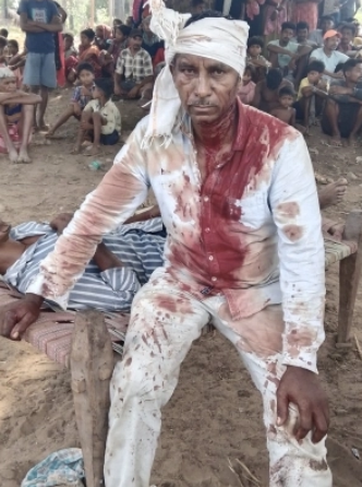 수크라 마디(Sukra Madi) 목사