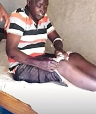 우간다 팔리사 지역의 존 마이클 오코엘 목사와 그의 부목사는 지난 1월 30일 신앙을 이유로 폭행을 당했다