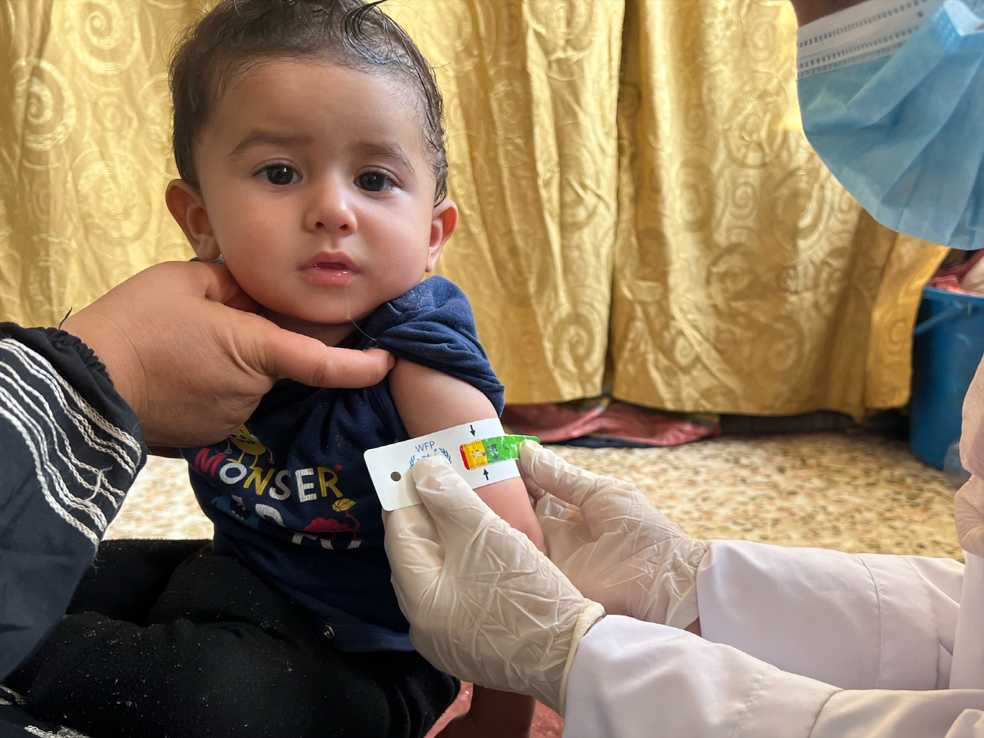 시리아 북동부 피난민 아동이 월드비전의 의료·영양 지원을 받고 건강한 체중으로 회복한 모습