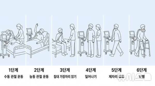 인공호흡기 중환자 조기 재활, 높은 단계 도달해야 효과