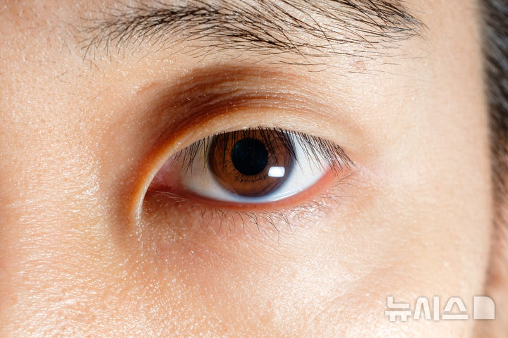 눈앞 부유물 늘고 번쩍이면 망막 점검해야