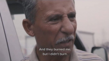 IS가 산 채로 세 번이나 불태웠지만 살아남은 이라크 기독교인 남성