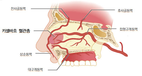 치료스위치