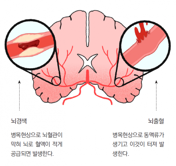 머리앤코글로벌한의원