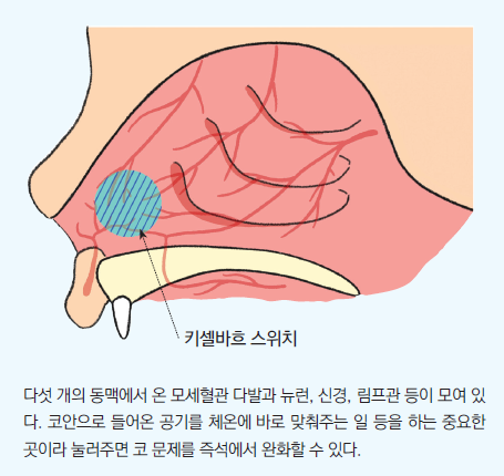 키셀바흐 스위치