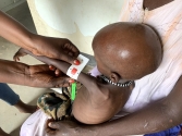 남수단에서 영양실조 검사를 받는 아이 (빨간색 표시는 중증 급성영양실조를 앓고 있음을 나타낸다)
