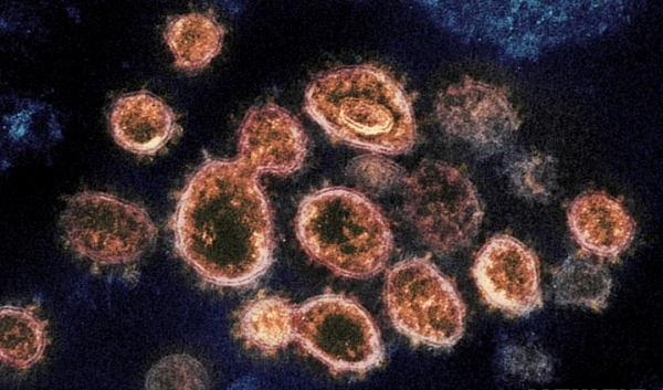코로나19 바이러스의 전자현미경 사진. ⓒ미 국립알레르기·전염병연구소(NIAID) 로키마운틴연구소